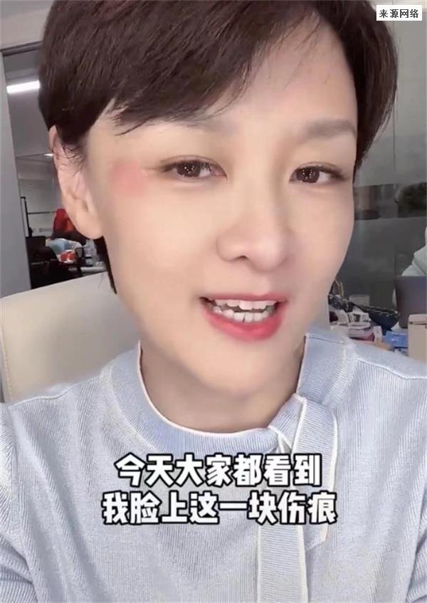 央视前主持李小萌被家暴了吗 本人亲自回应