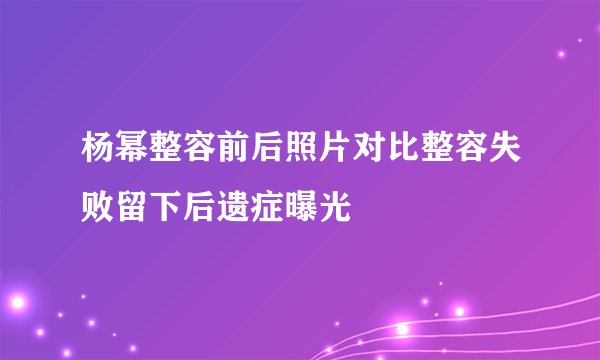 杨幂整容前后照片对比整容失败留下后遗症曝光