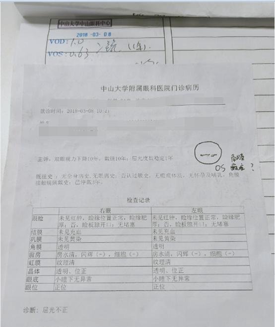 分享一下700多度近视眼的全飞秒手术经历