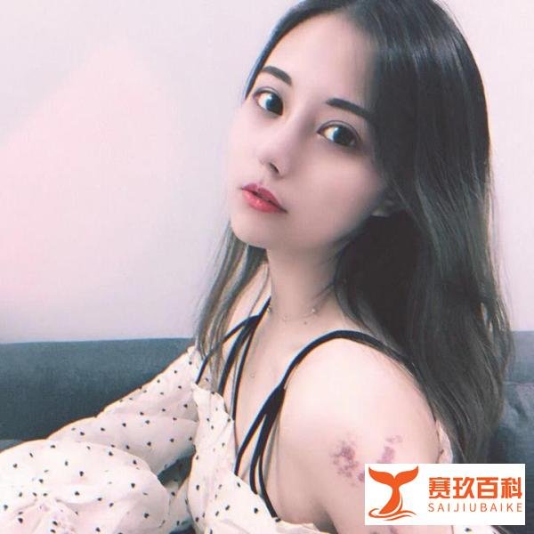 北京隆鼻医院医生价格22000，术后恢复记录分享