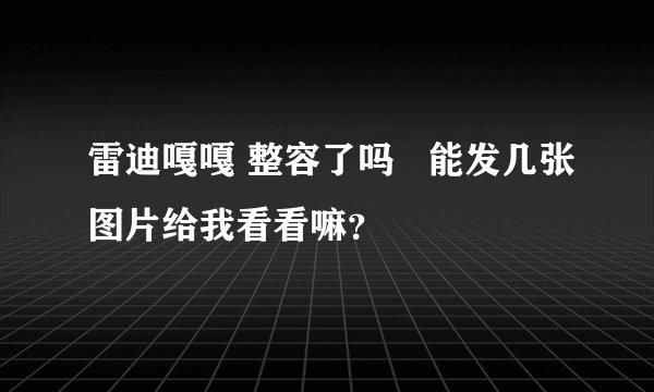 雷迪嘎嘎 整容了吗 能发几张图片给我看看嘛?