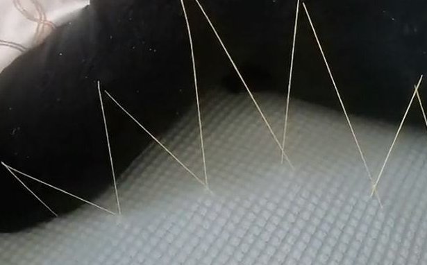 山东男子躺5小时不起被妻子缝在沙发上,这是个什么样的场景?
