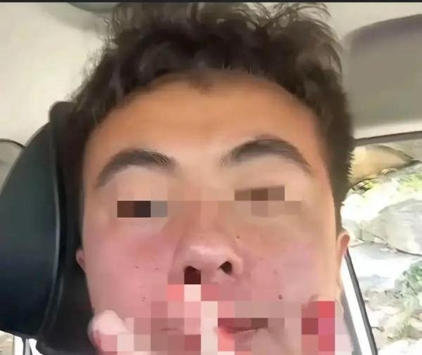 路虎女打人后续，被打小伙再次发声揭真相，女子身份曝光，更多细节流出