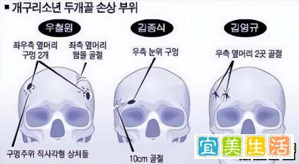 奇闻悬案：韩国青蛙少年失踪案，回不了家的孩子们