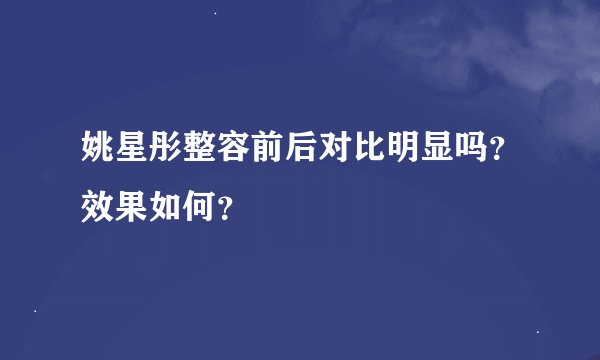 姚星彤整容前后对比明显吗？效果如何？