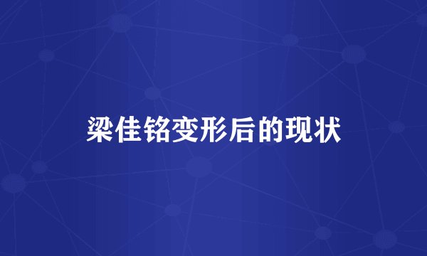 梁佳铭变形后的现状