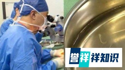 2岁男童眼睛现4条寄生虫游动