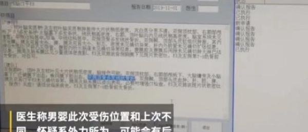 残忍!被插绣花针,50天男婴二度入院