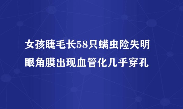 女孩睫毛长58只螨虫险失明 眼角膜出现血管化几乎穿孔
