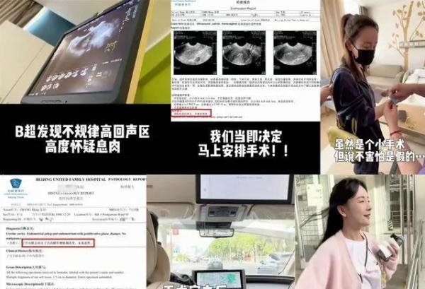 张檬官宣怀孕,昔日备孕艰辛过程曝光,曾患焦虑和惊恐看心理医生