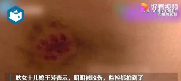 新华社五问安阳狗咬人事件 这是咋情况？