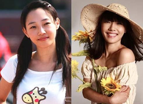 白百合承认整容是怎么回事？