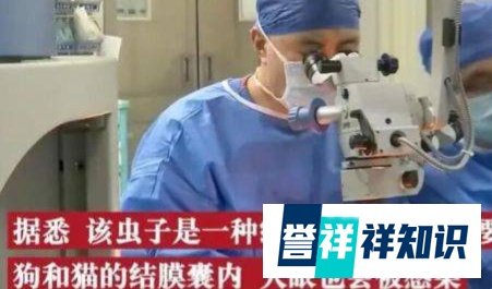 2岁男童眼睛现4条寄生虫游动