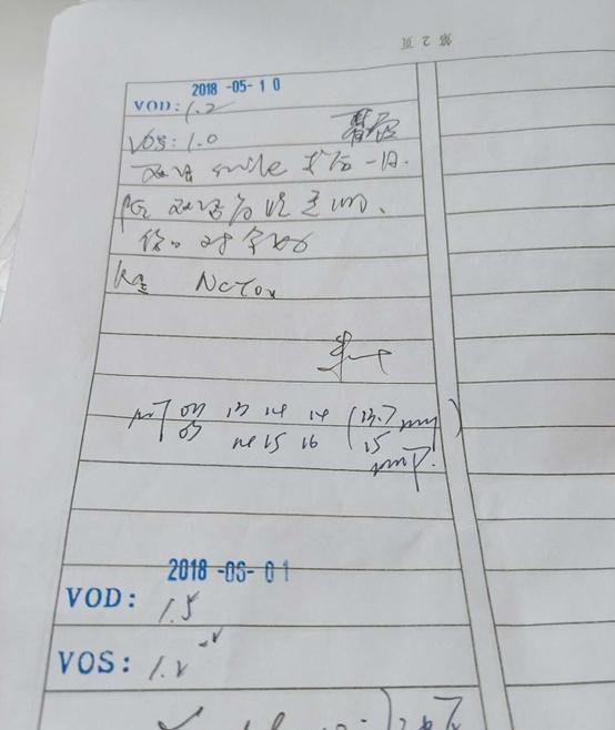 分享一下700多度近视眼的全飞秒手术经历
