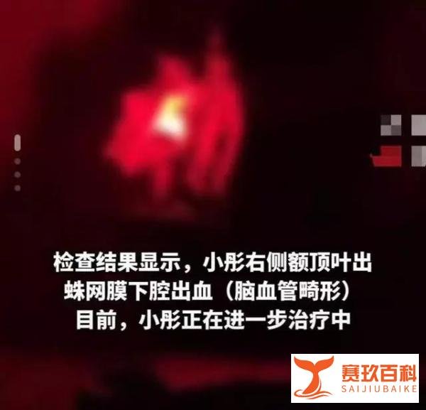 到底是剧本杀太恐怖,22岁被吓出“老年病”