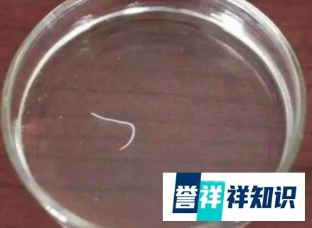 2岁男童眼睛现4条寄生虫游动