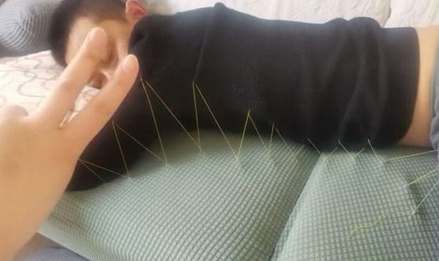 山东男子躺5小时不起被妻子缝在沙发上,这是个什么样的场景?