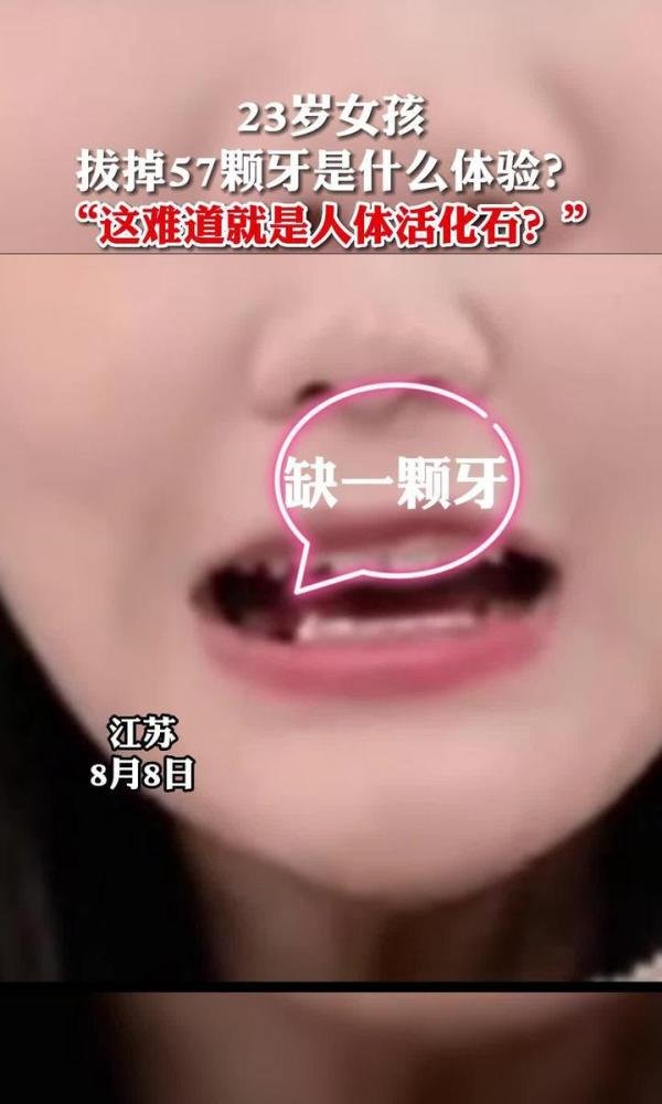 23岁妙龄少女拔出57颗牙是什么体验？
