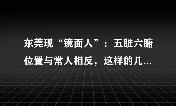 东莞现“镜面人”：五脏六腑位置与常人相反，这样的几率有多罕见？
