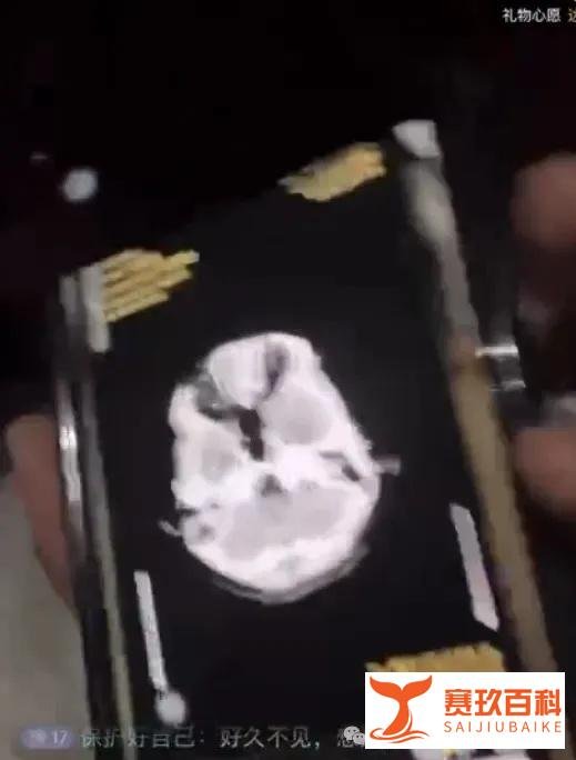 昔日周淑怡二台女主播出轨背刺退播后复出，称自己事业粉很多，目前脑子出现问题！