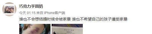 德云社张九南回应被前妻控诉家暴出轨:等判决