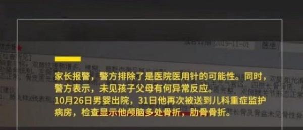 残忍!被插绣花针,50天男婴二度入院