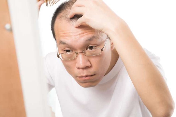 植发费用换算后超房价,植发到底为什么这么贵?