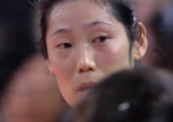 朱婷被打到眼睛 这是咋情况？