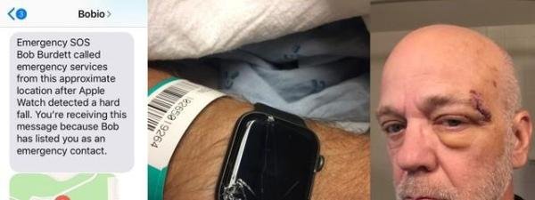 Apple Watch或可打断噩梦 关键时刻还能救你一命
