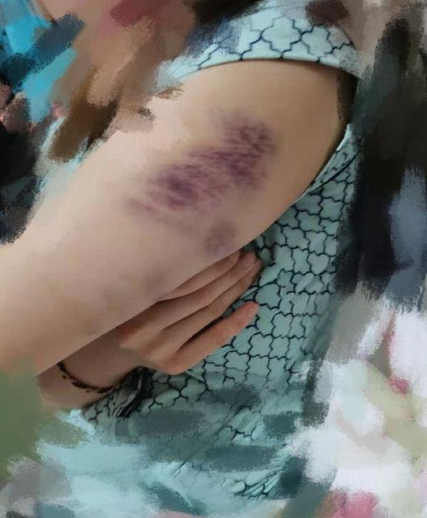 德云社张九南回应被前妻控诉家暴出轨:等判决