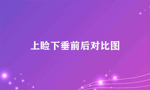 上睑下垂前后对比图