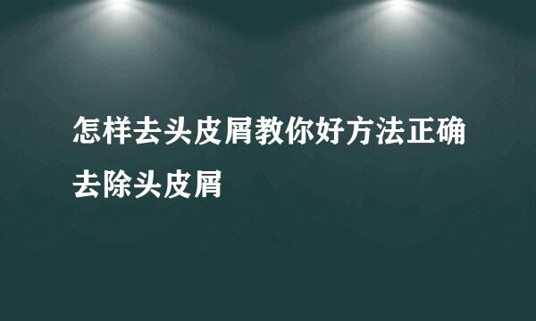 怎样去头皮屑教你好方法正确去除头皮屑