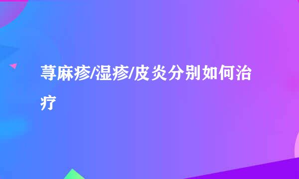荨麻疹/湿疹/皮炎分别如何治疗