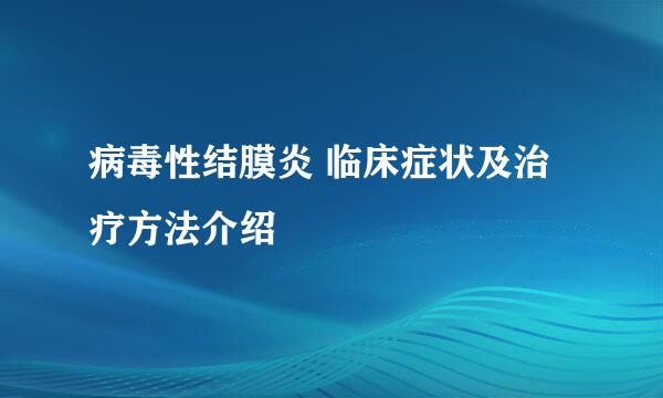 病毒性结膜炎 临床症状及治疗方法介绍