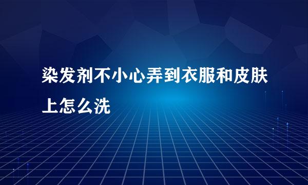染发剂不小心弄到衣服和皮肤上怎么洗