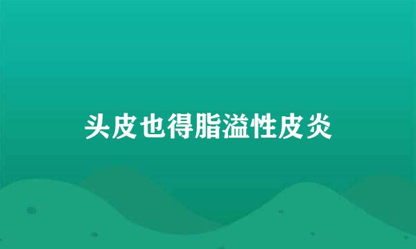 头皮也得脂溢性皮炎