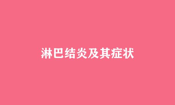 淋巴结炎及其症状