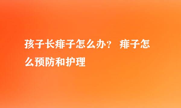 孩子长痱子怎么办? 痱子怎么预防和护理