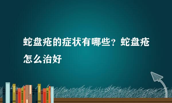 蛇盘疮的症状有哪些？蛇盘疮怎么治好