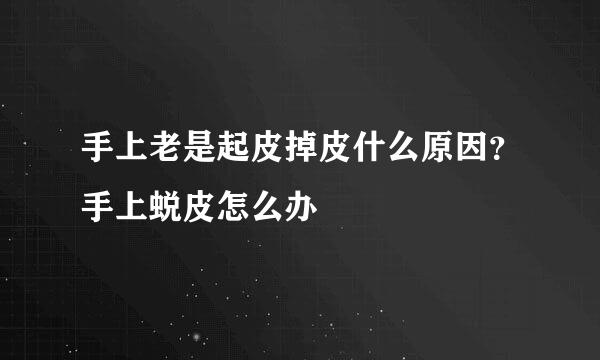 手上老是起皮掉皮什么原因？手上蜕皮怎么办
