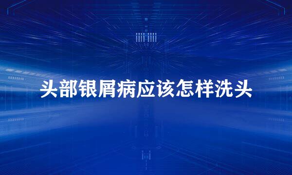 头部银屑病应该怎样洗头