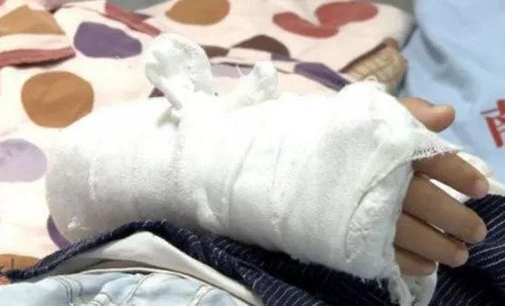 4岁女童户外课摔倒致手臂骨折,学校是否该为此负全责?