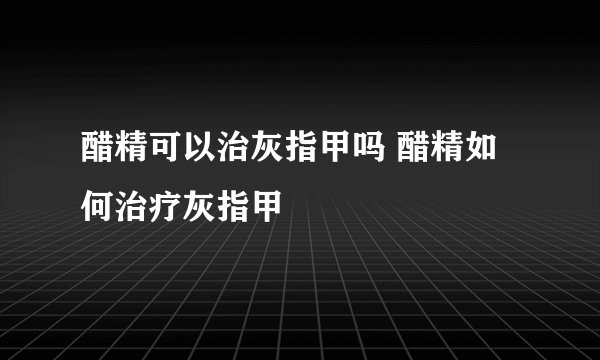 醋精可以治灰指甲吗 醋精如何治疗灰指甲