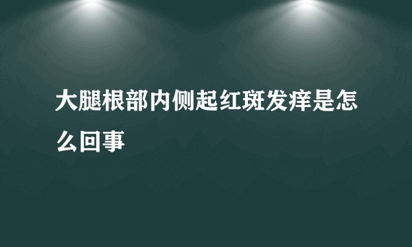 大腿根部内侧起红斑发痒是怎么回事