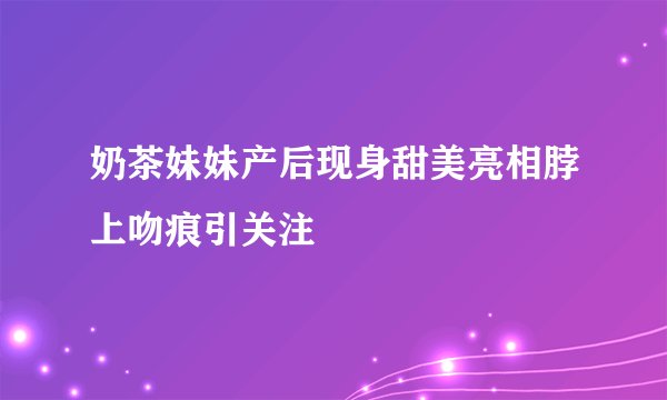 奶茶妹妹产后现身甜美亮相脖上吻痕引关注