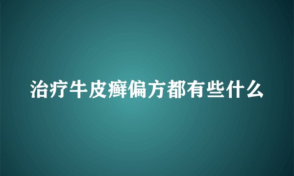 治疗牛皮癣偏方都有些什么