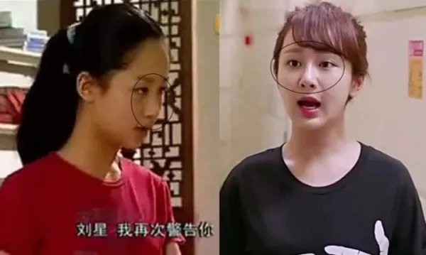 杨紫整容了吗?