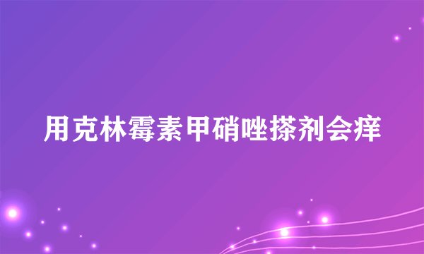 用克林霉素甲硝唑搽剂会痒