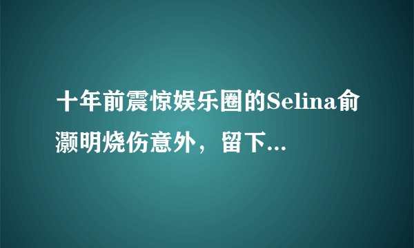 十年前震惊娱乐圈的Selina俞灏明烧伤意外，留下太多谜团…