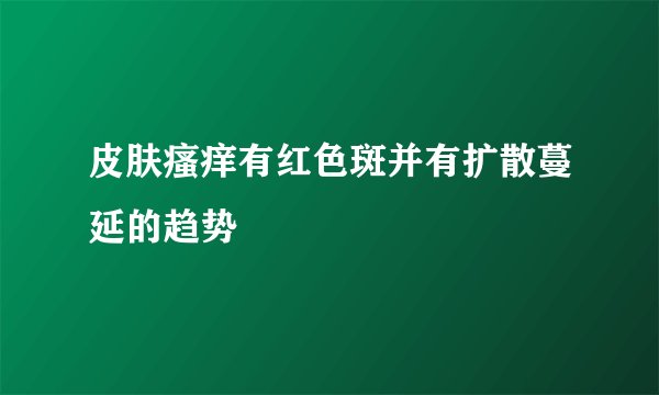 皮肤瘙痒有红色斑并有扩散蔓延的趋势